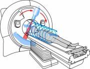 TomoTherapy vs Varian the gloves are off En